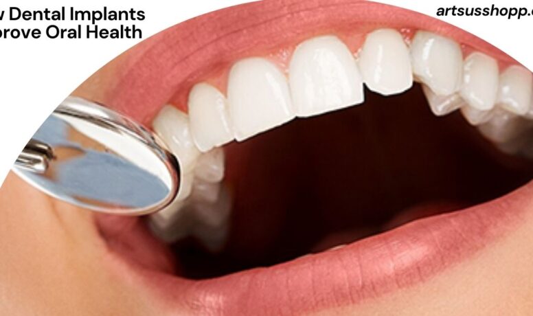How Dental Implants Improve Oral Health
