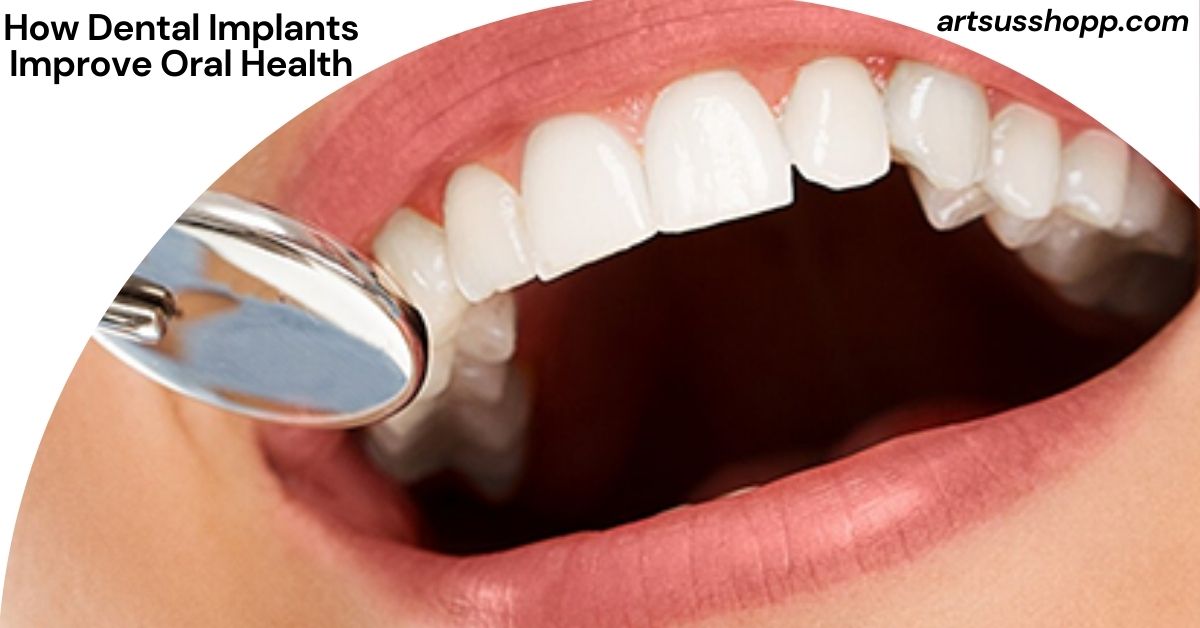 How Dental Implants Improve Oral Health