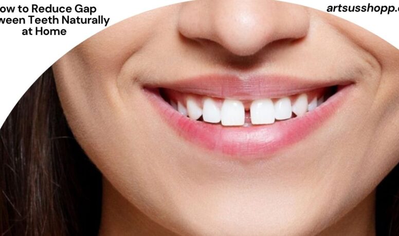 How to Reduce Gap Between Teeth Naturally at Home