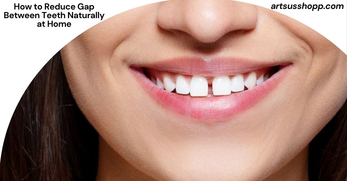 How to Reduce Gap Between Teeth Naturally at Home